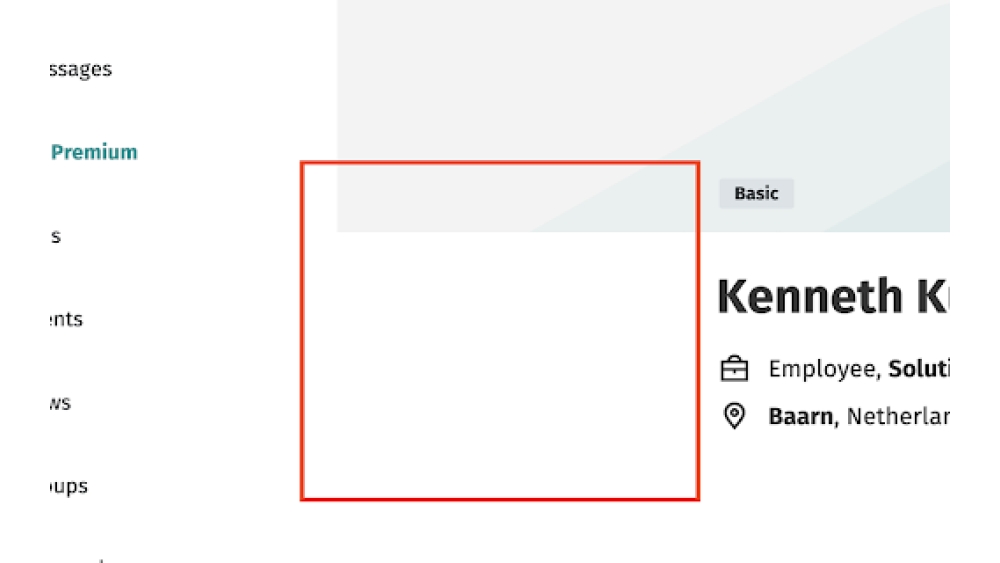 LinkedIn/XING Image Hider - Chrome Extension