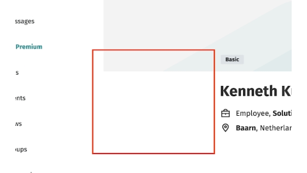 LinkedIn/XING Image Hider - Chrome Extension