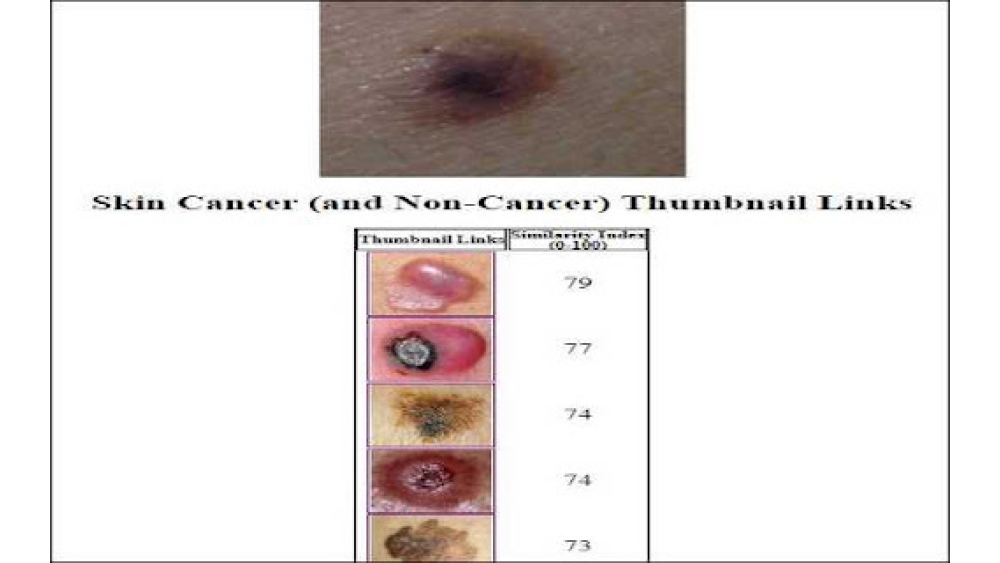 Mole Similarity Chrome Extension - Chrome Extension