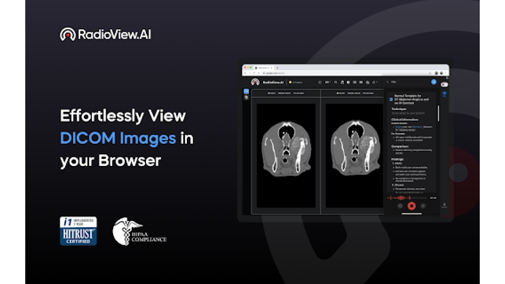 RadioView.AI - Chrome Extension