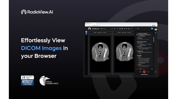 RadioView.AI - Chrome Extension