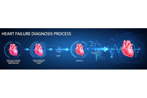 Как ИИ помогает прогнозировать ухудшение состояния пациентов с сердечной недостаточностью